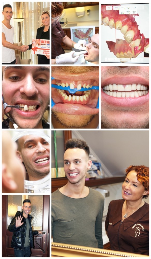 Keramik-Veneers